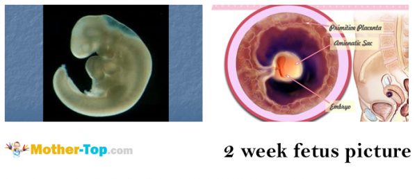2 week fetus picture