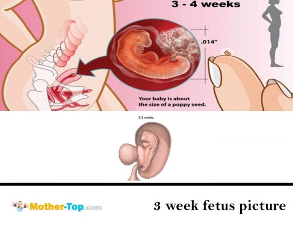 3 week fetus picture