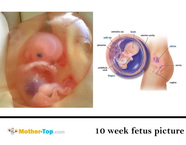 10 week fetus picture