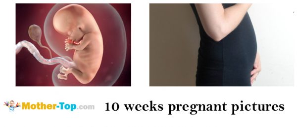 10 weeks pregnant pictures