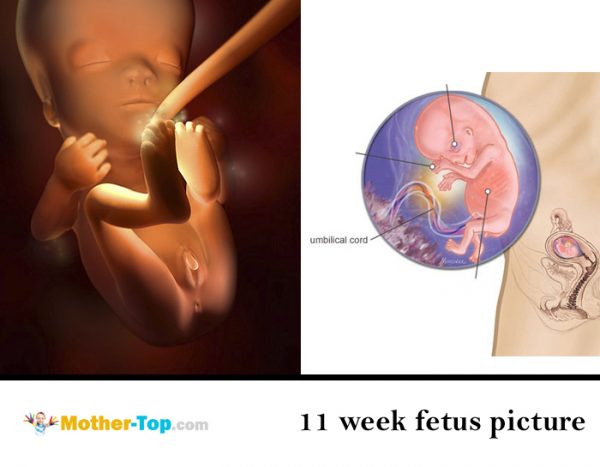 11 week fetus picture