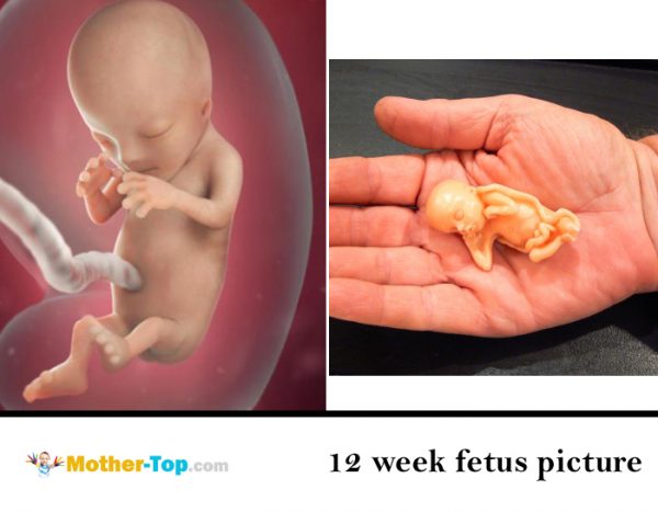 12 week fetus picture