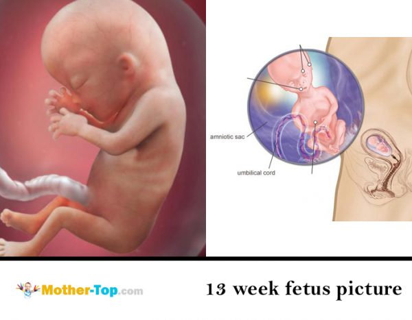 13 week fetus picture