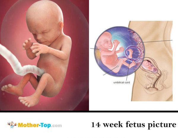 14 week fetus picture