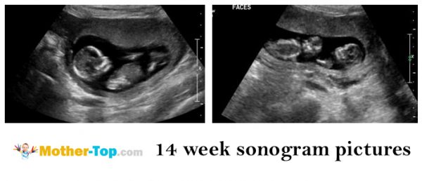 14 week sonogram pictures