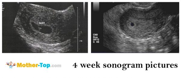 4 week sonogram pictures
