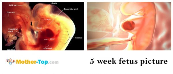 5 week fetus picture