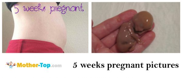 5 weeks pregnant pictures