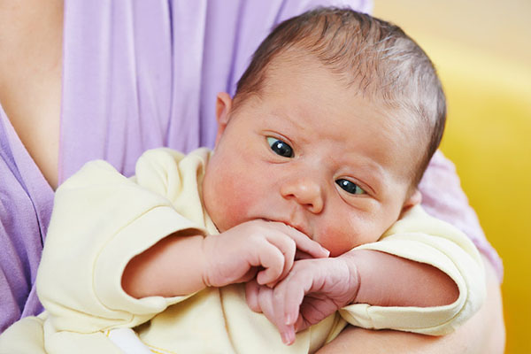 How to treat crossed eyes Strabismus in newborns