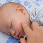 Staph infection and MRSA symptoms in newborns
