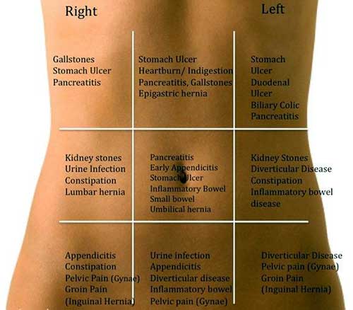 abdominal-pain-localization