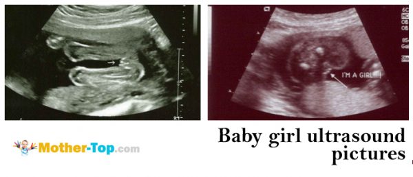 baby girl ultrasound pictures