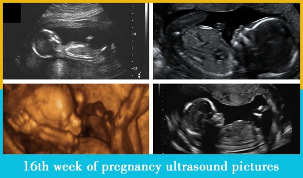 16th week of pregnancy ultrasound pictures