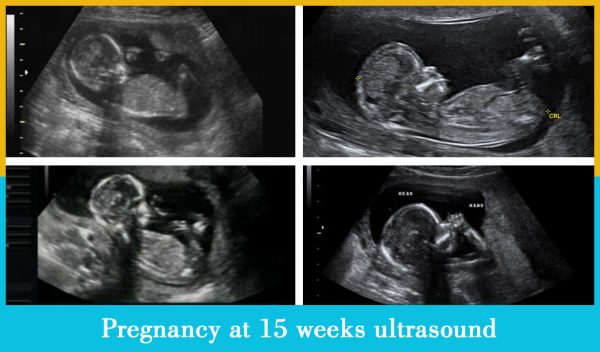 pregnancy at 15 weeks ultrasound