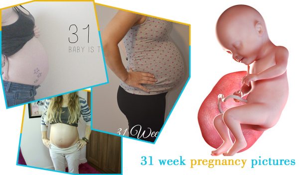 31 week pregnancy pictures