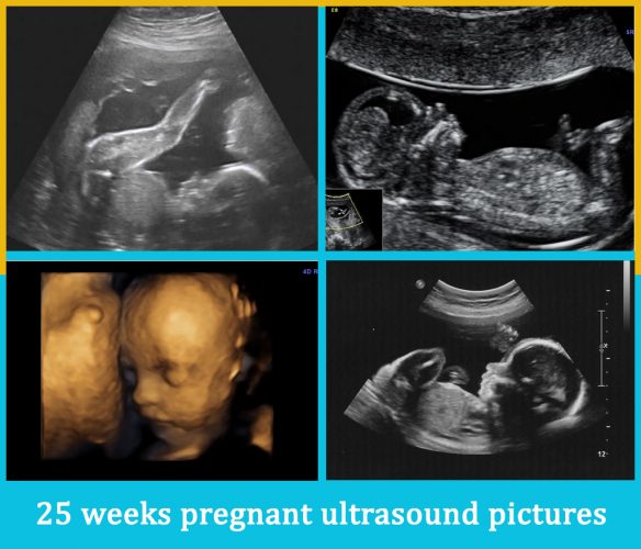 25 weeks pregnant ultrasound pictures
