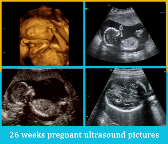 26 weeks pregnant ultrasound pictures