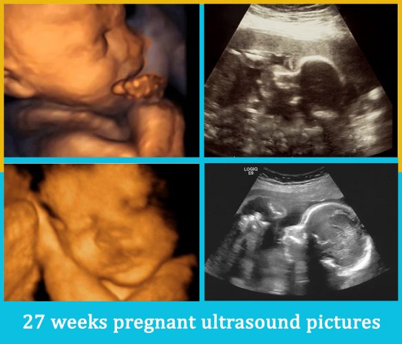 27 weeks pregnant ultrasound pictures