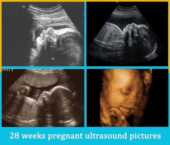 28 weeks pregnant ultrasound pictures