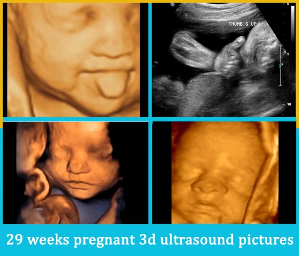 29 weeks pregnant 3d ultrasound pictures