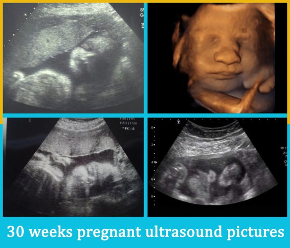 30 weeks pregnant ultrasound pictures 