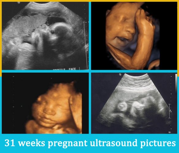 31 weeks pregnant ultrasound pictures