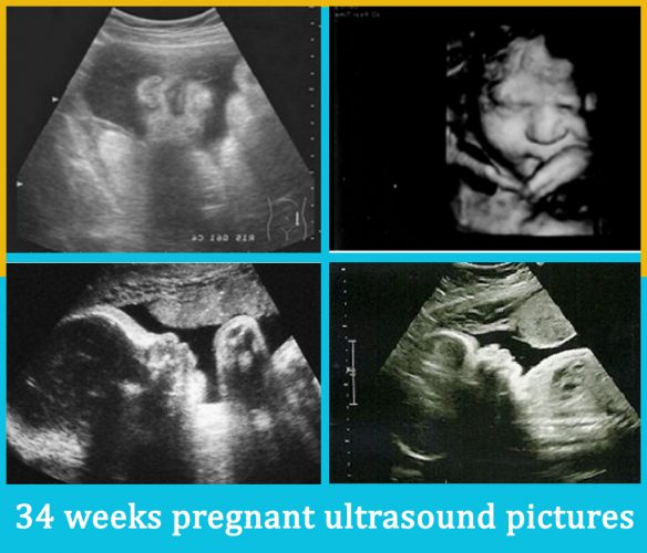 34 weeks pregnant ultrasound pictures