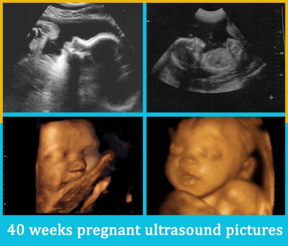 40 weeks pregnant ultrasound pictures