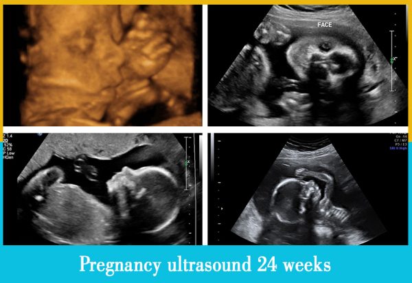 pregnancy ultrasound 24 weeks