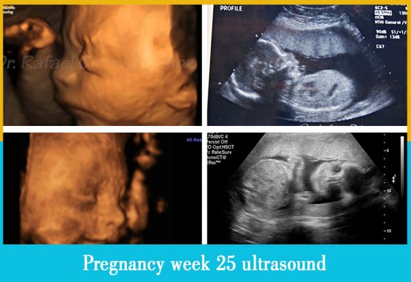 pregnancy week 25 ultrasound