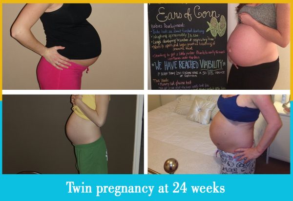 twin pregnancy at 24 weeks