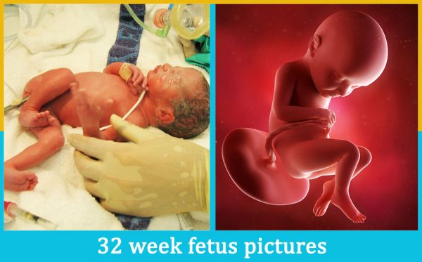 32 week fetus pictures