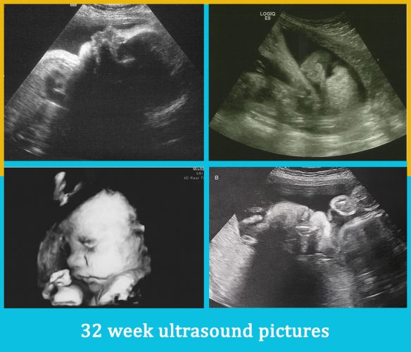 32 week ultrasound pictures