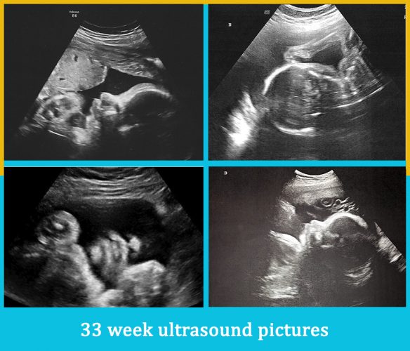 33 week ultrasound pictures