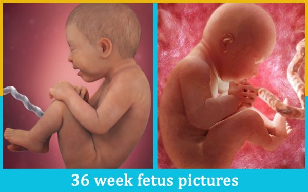36 week fetus pictures