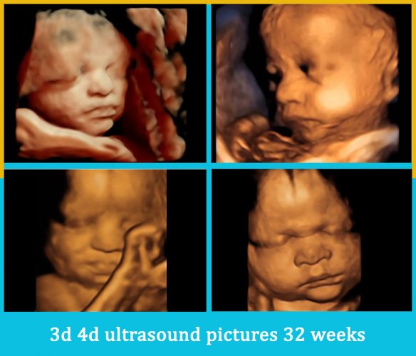 3d 4d ultrasound pictures 32 weeks