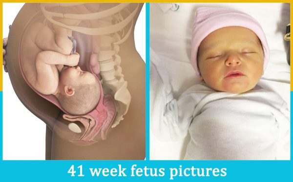 41 week fetus pictures