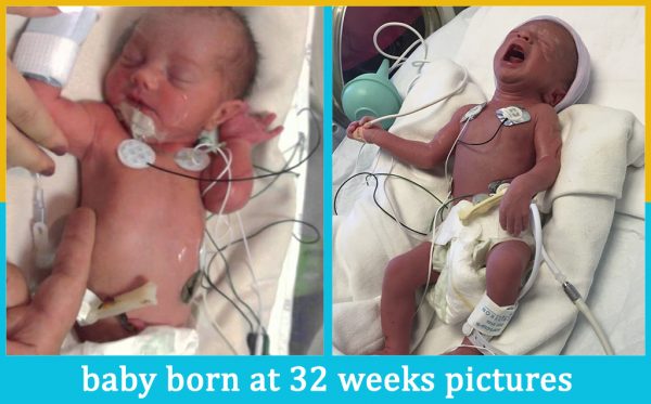 baby born at 32 weeks pictures