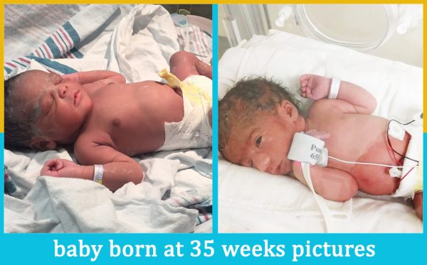 baby born at 35 weeks pictures