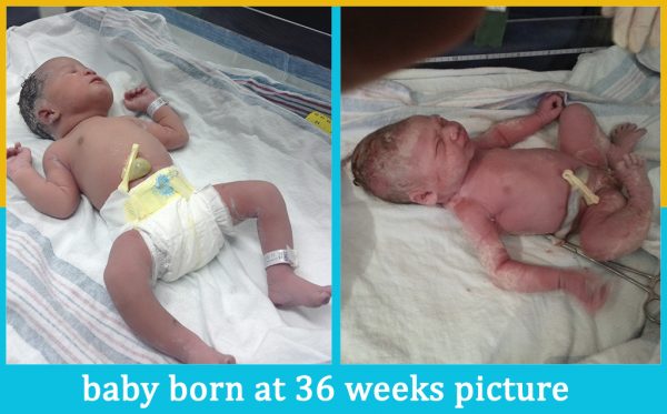 baby born at 36 weeks picture